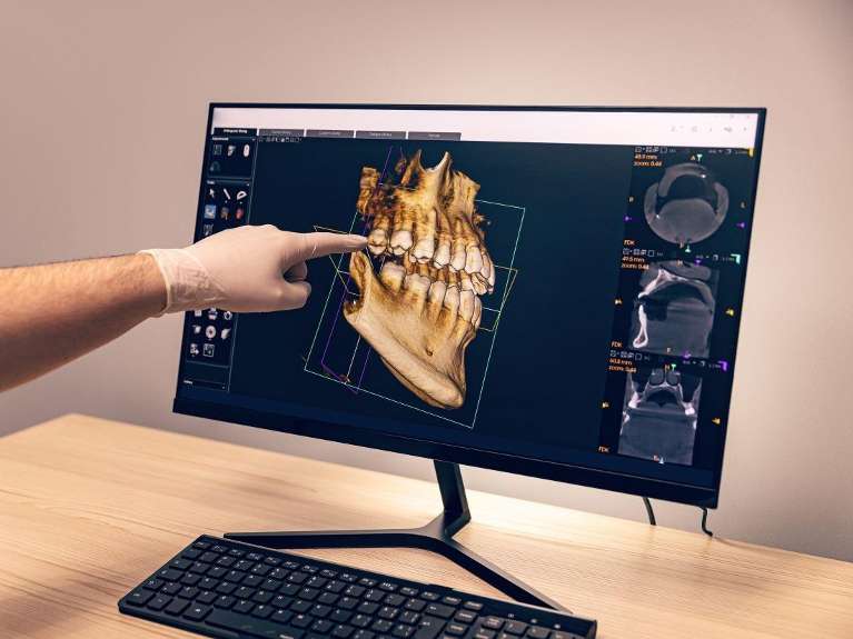 CBCT Cone Beam Technology | white hills dentist