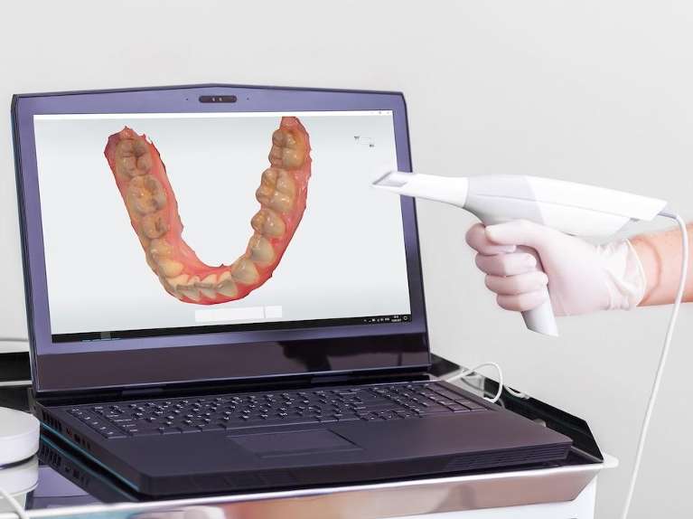 dentist looking at digital impressions | dentist white hills vic