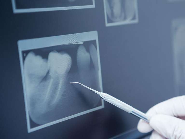 Digital X-Rays and Sensors | dentist 3550