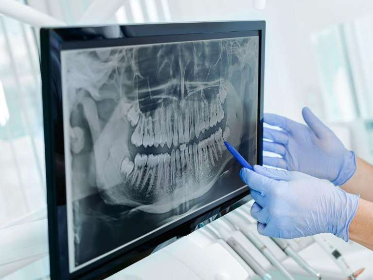 Panoramic X-Rays | dental x-rays white hills vic